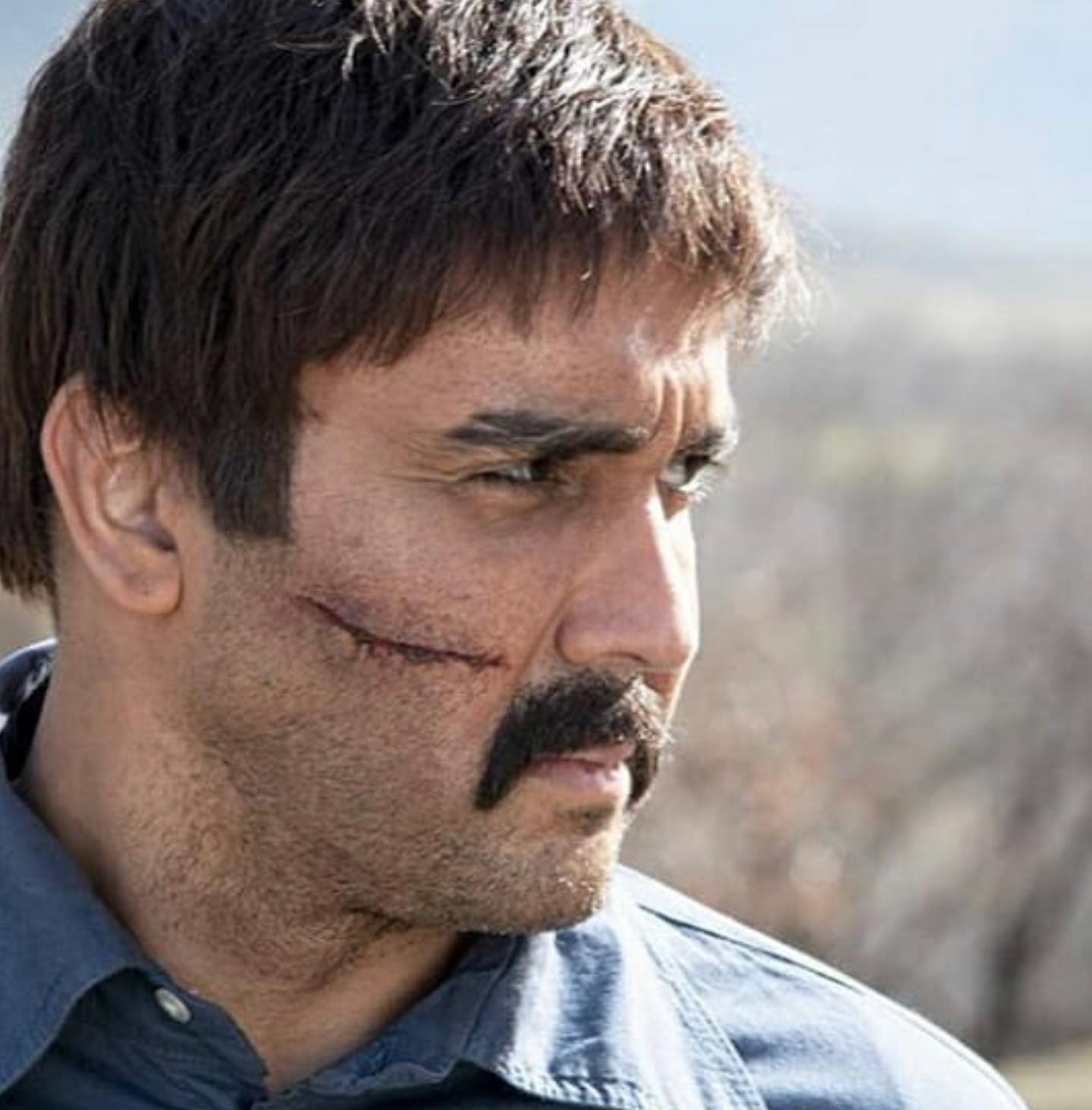 آیا پوریا پورسرخ عمل زیبایی کرده است؟ 