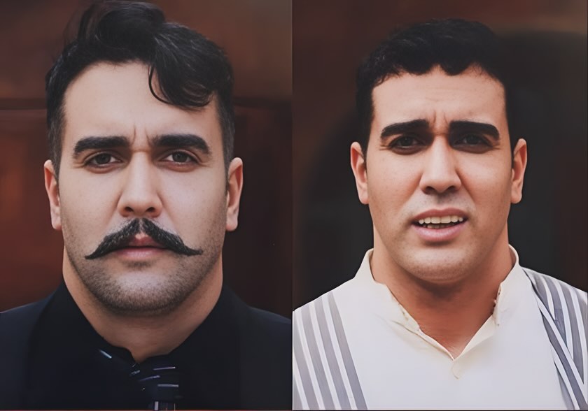 عکس پوریا پورسرخ: قبل و بعد از عمل زیبایی 