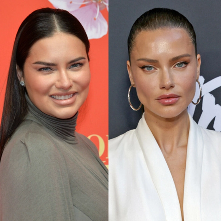 آدریانا لیما قبل عمل