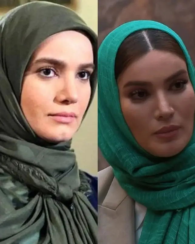 آیا متین ستوده جراحی زیبایی صورت انجام داده است