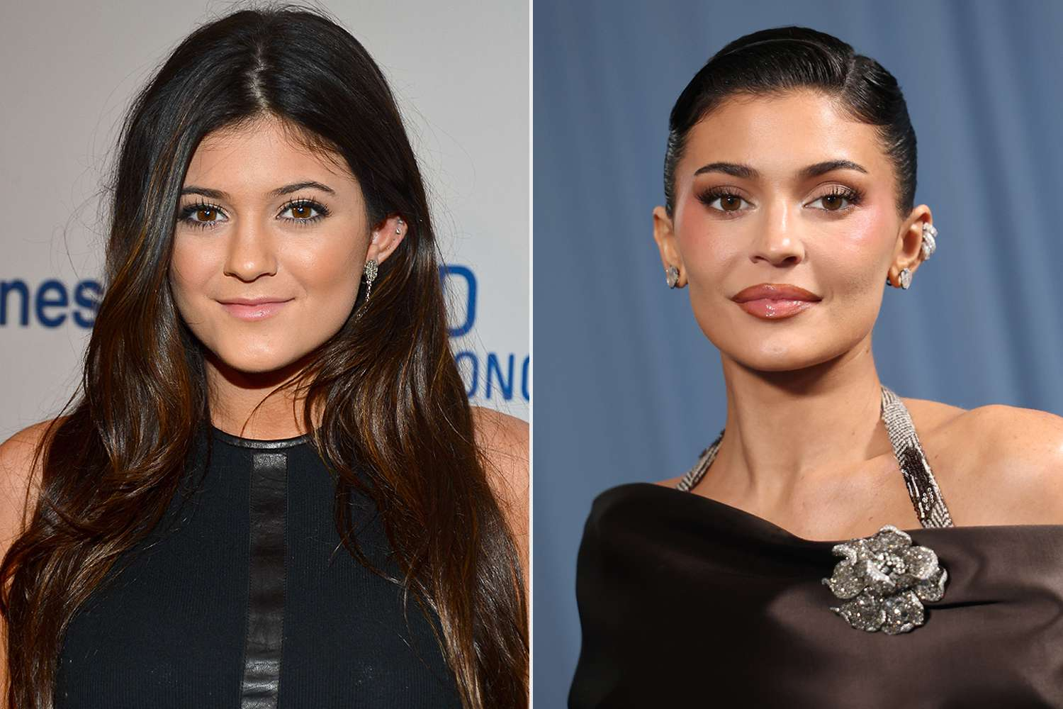 بررسی ظاهر طبیعی کایلی جنر پیش از جراحی زیبایی بررسی ظاهر طبیعی کایلی جنر پیش از جراحی زیبایی