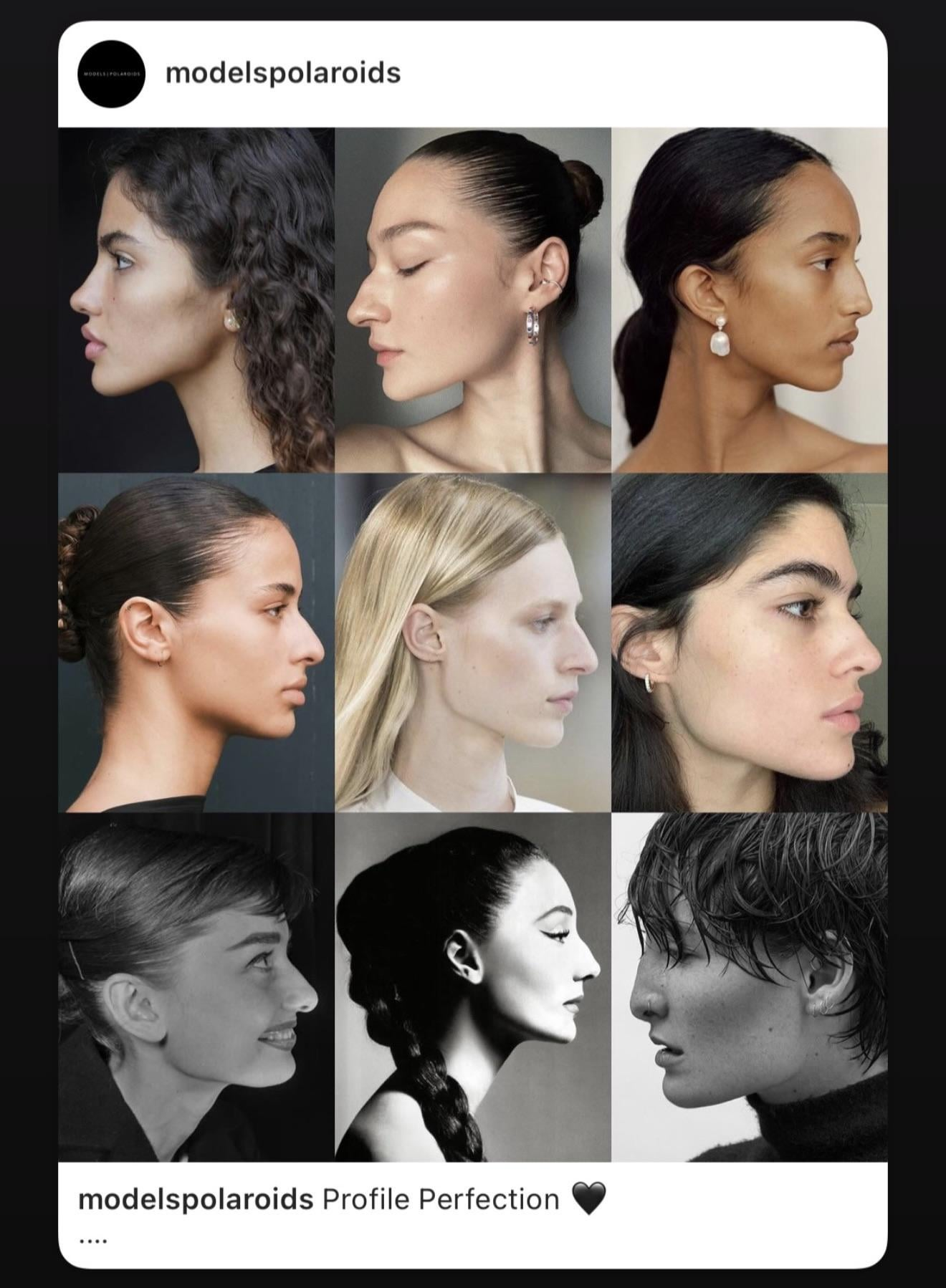 ترند قوز بینی