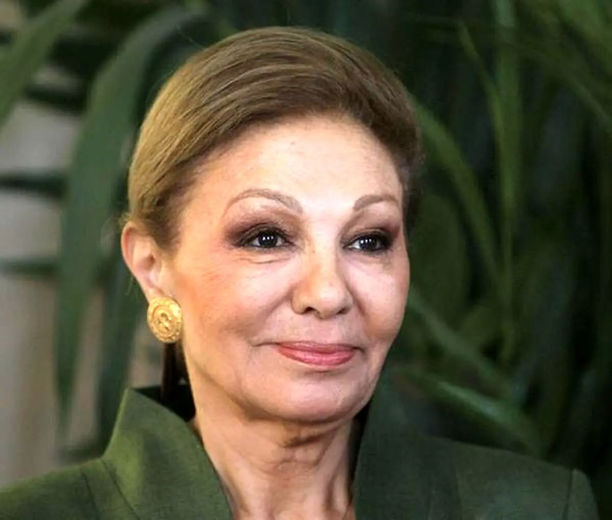 جراحی صورت فرح پهلوی