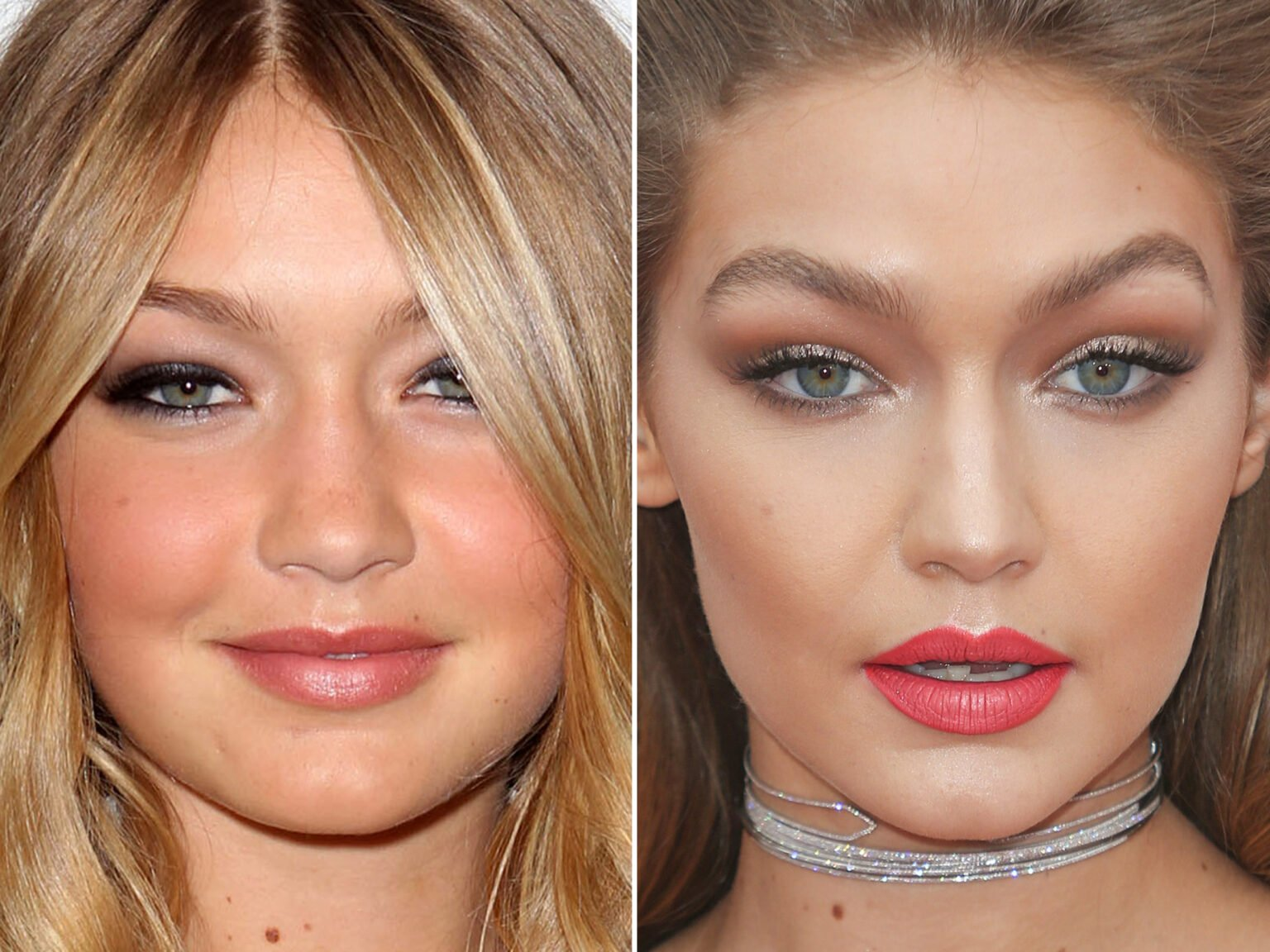 جی جی حدید قبل از عمل زیبایی جی جی حدید قبل از عمل زیبایی