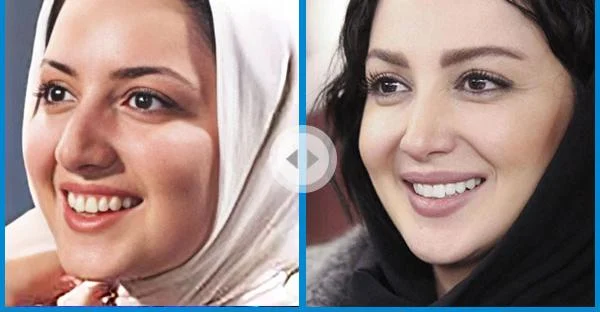 عمل بینی لیلا اوتادی و مدل بینی او 