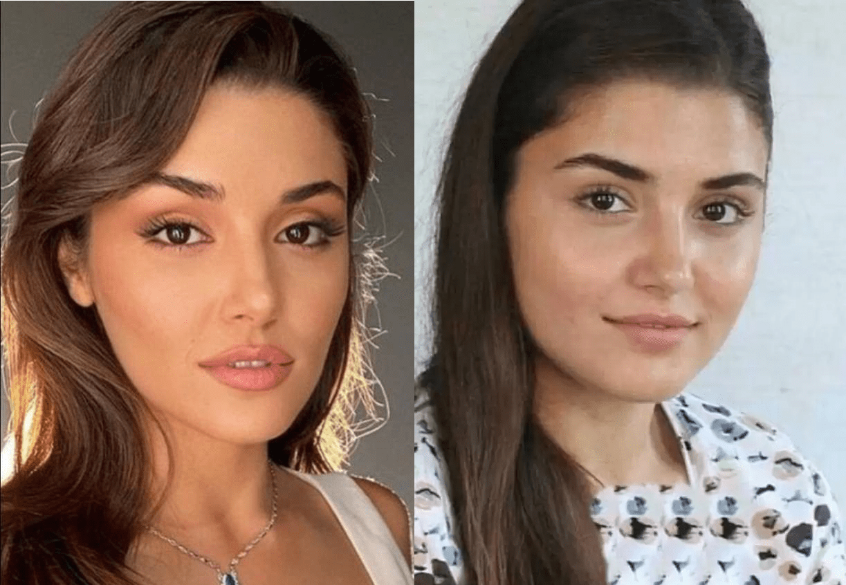 عمل بینی هانده ارچل و مدل بینی او 