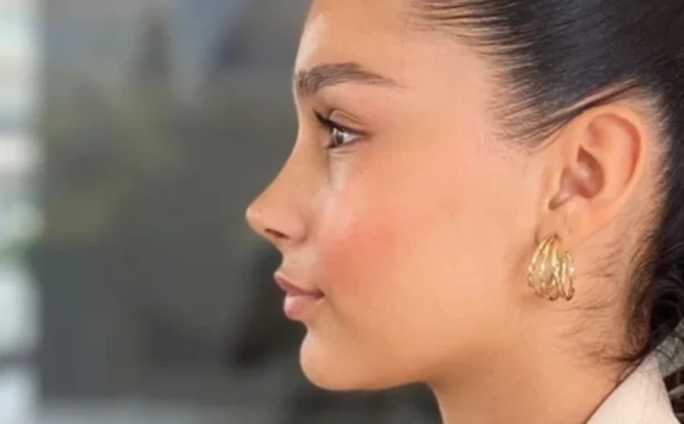 مجموعه‌ای از عکس‌های بینی جراحی شده