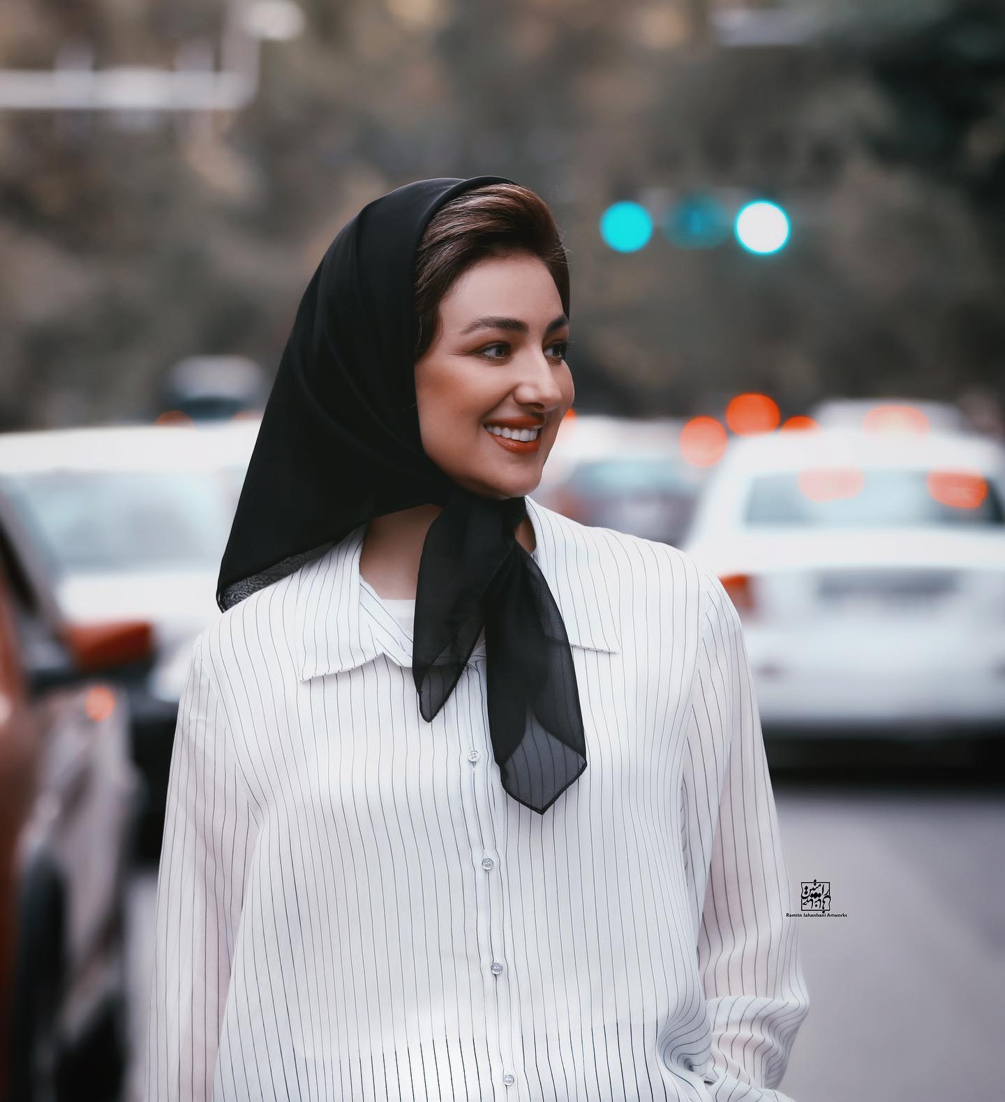 ویدا جوان قبل و بعد عمل بینی